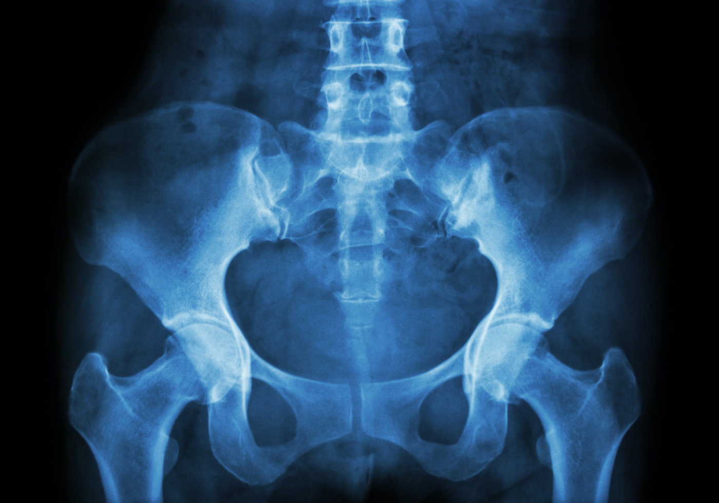 Understanding the Signs and Symptoms of Pelvic Prolapse - Complete ...